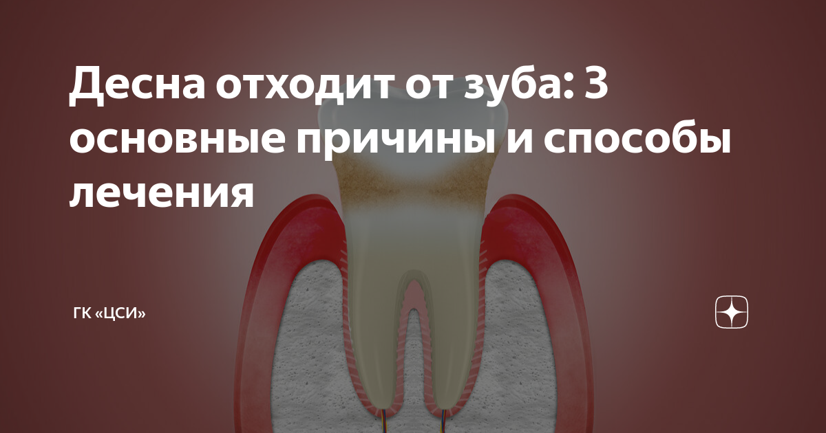 как понять есть ли гной в десне после удаления зуба