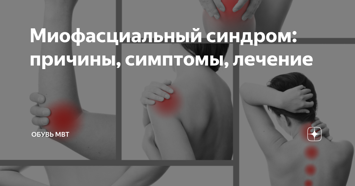Миофасциальный синдром: причины, симптомы, лечение | Обувь MBT | Дзен
