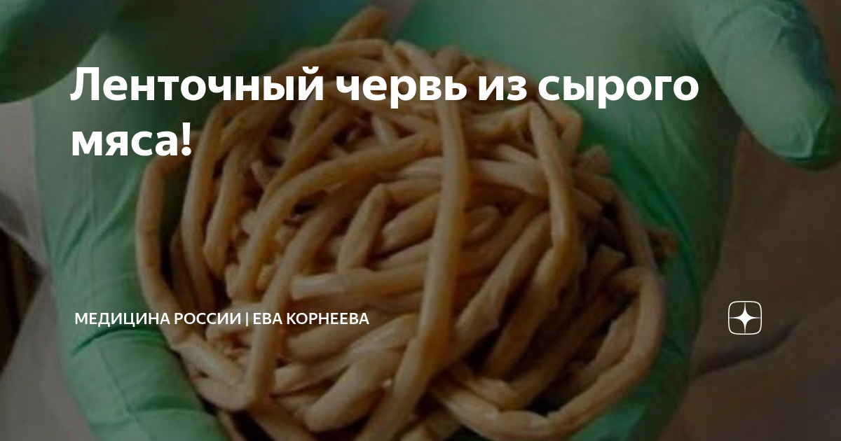 Ленточный червь из сырого мяса! | Медицина России | Ева Корнеева | Дзен