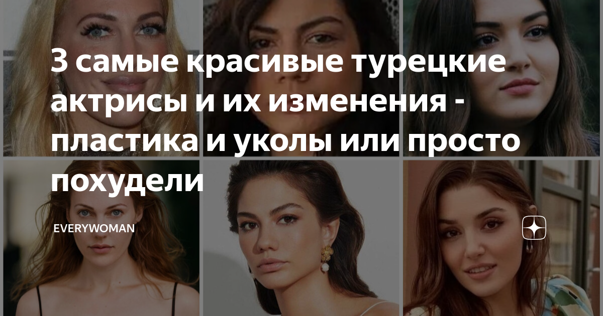 3 самые красивые турецкие актрисы и их изменения - пластика и уколы или ...