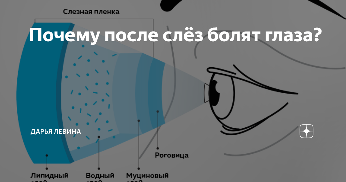 Почему могут болеть глаза и как это исправить