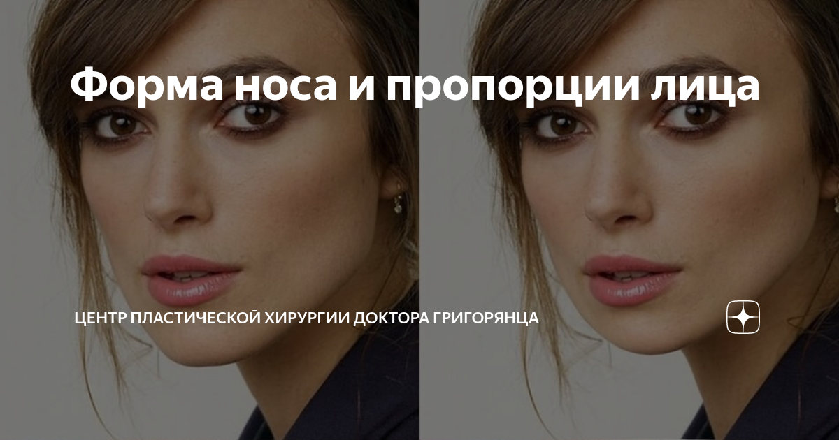 Форма носа и пропорции лица | Центр пластической хирургии доктора ...