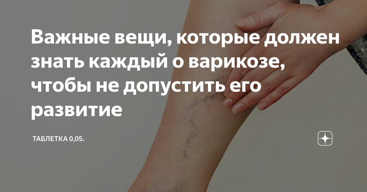 Важные вещи, которые должен знать каждый о варикозе, чтобы не допустить ...