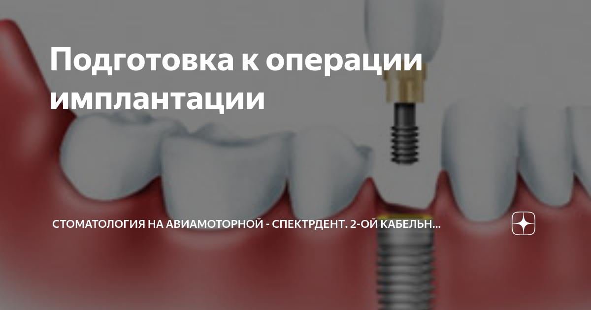 Извлечение абатмента из импланта под микроскопом Стоматологическая клиника "Бела