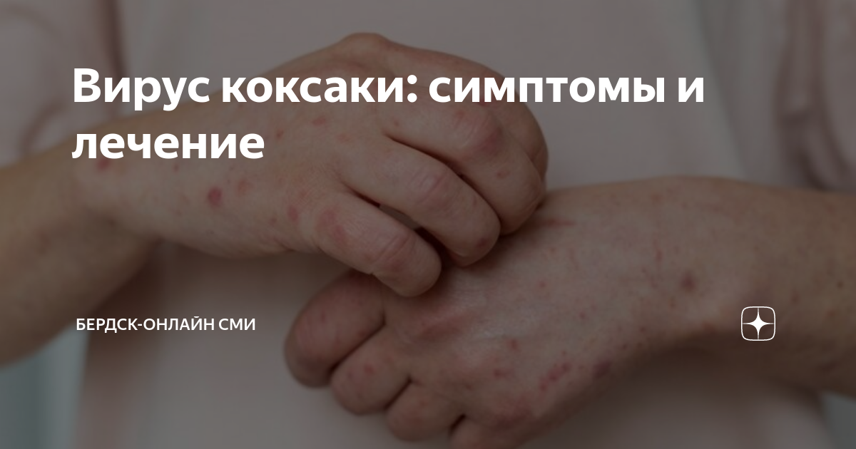 Вирус коксаки: симптомы и лечение | Беседа Онлайн | Дзен