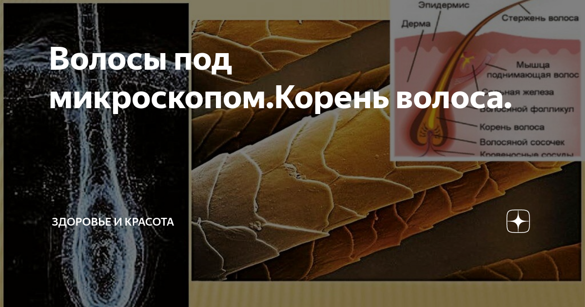 Лечение корней под микроскопом Лечение под микроскопом