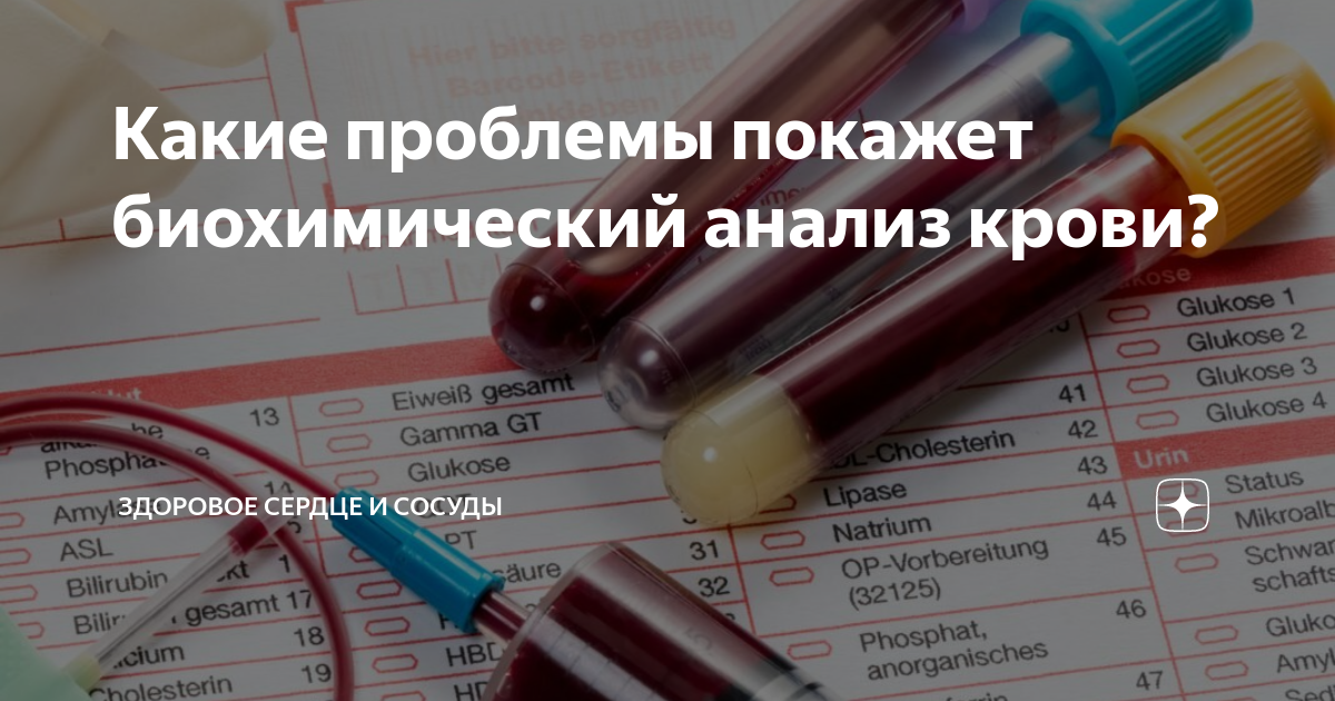 Как проверить поджелудочную железу какие анализы сдать. Подготовка к общему и биохимическому анализам крови. Кровь на биохимию подготовка к анализу. Подготовка к биохимическому анализу. Подготовка к биохимическому анализу крови взрослого.