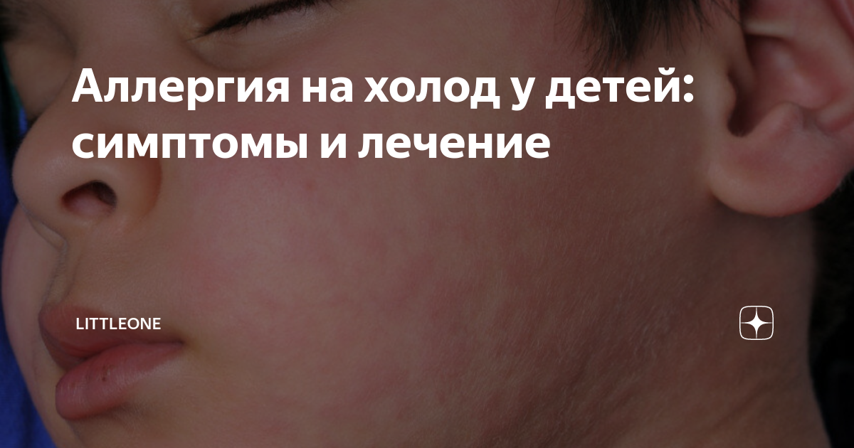 Памятка по мерам предосторожности в холодное время года