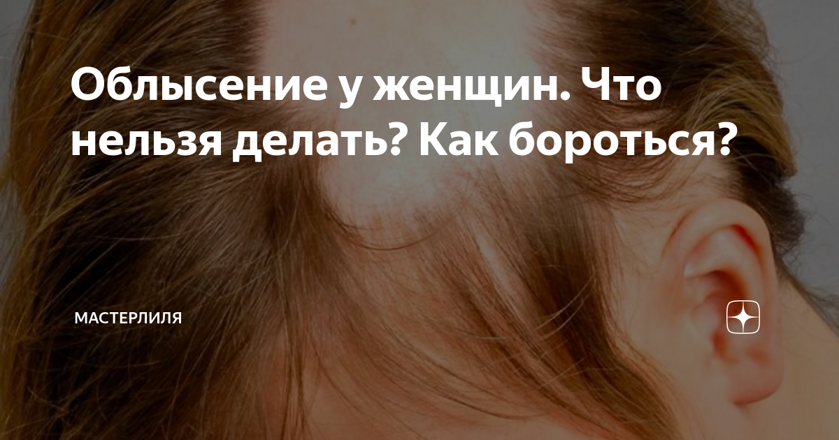 Облысение у женщин. Что нельзя делать? Как бороться? | МастерЛиля | Дзен