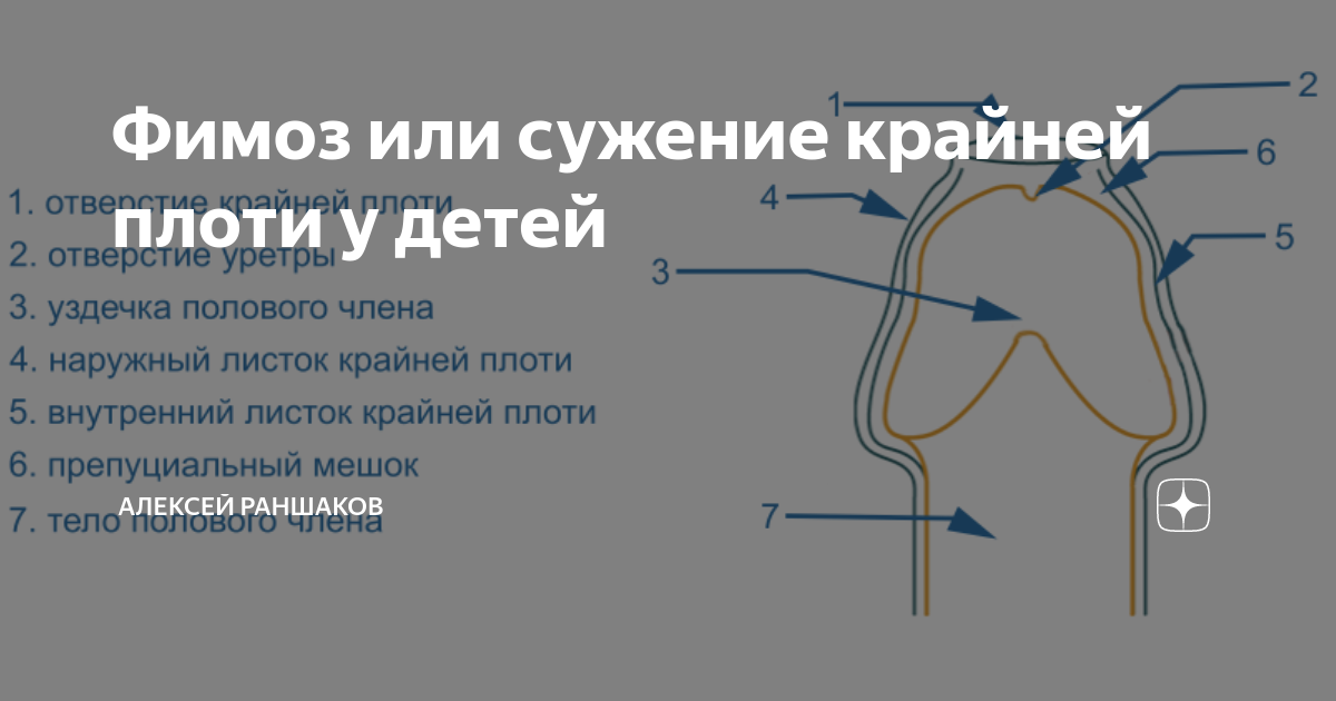 Скачать фотографию СМЕГМА ЧТО ДЕЛАТЬ № 23