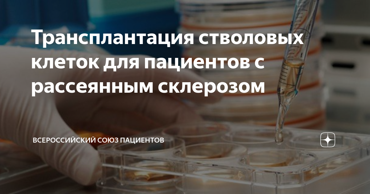 Стволовые клетки рассеянный склероз пирогов