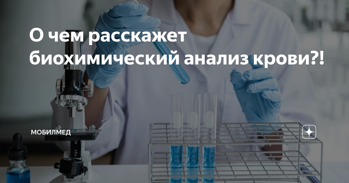 О чем расскажет биохимический анализ крови?! | МобилМед | Дзен