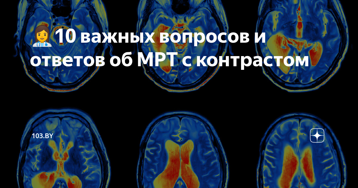 Мрт с жидкостью. Мрт с контрастом и без. Мрт с контрастом и без в чем разница. Мрт с контрастированием и без в чем разница. Мрт с легким сердцем сагитальный подписи.