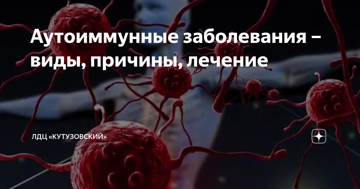Аутоиммунные заболевания – виды, причины, лечение | Evolutis Clinic | Дзен
