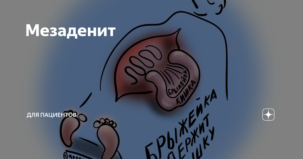 Неспецифический мезаденит. Мезентериальный мезаденит. Мезаденит симптомы.