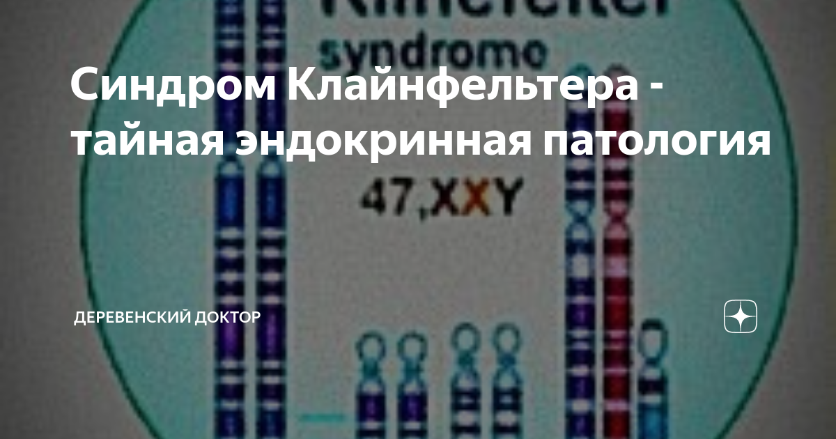Синдром Клайнфельтера - тайная эндокринная патология | Деревенский ...