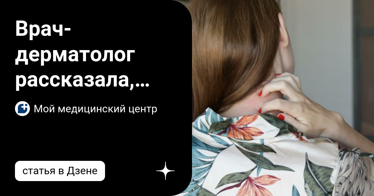 Врач-дерматолог рассказала, чем опасен псориаз и как его лечат | Мой ...