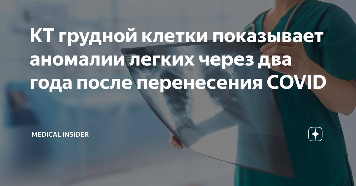 КТ грудной клетки показывает аномалии легких через два года после ...