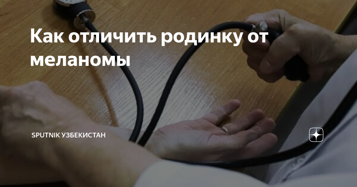 Как отличить родинку от меланомы | Sputnik Узбекистан | Дзен