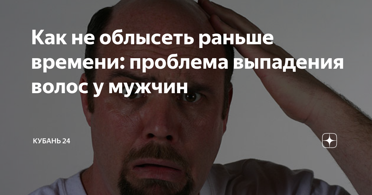 Как не облысеть раньше времени: проблема выпадения волос у мужчин ...