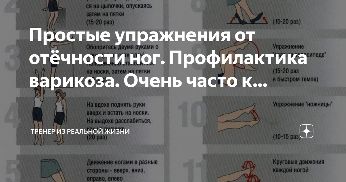 Упражнения для ног при отеках нижних конечностей. Зарядка для варикоза ног. Комплекс упражнений от отеков. Упражнения при варикозе нижних конечностей гимнастика. Комплекс упражнений от отеков.