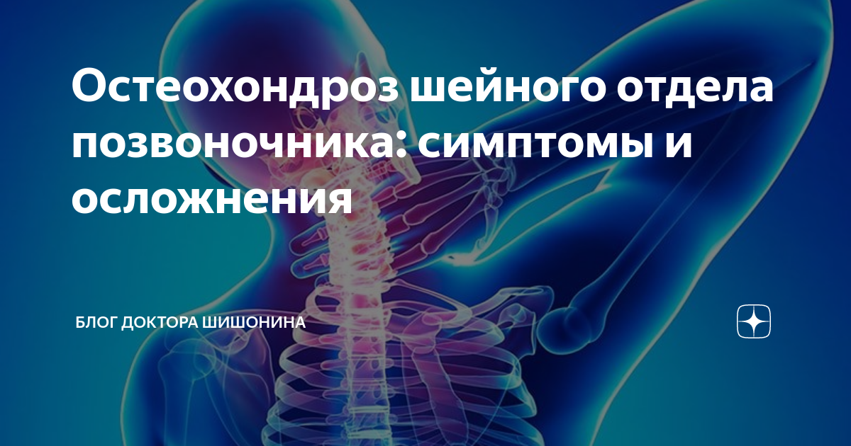 Шейный остеохондроз пройдет. Осложнения шейного остеохондроза. Симптомы остеохондроза шейного отдела позвоночника. Остеохондроз на шейном уровне. Стабильность и мобильность позвоночника.