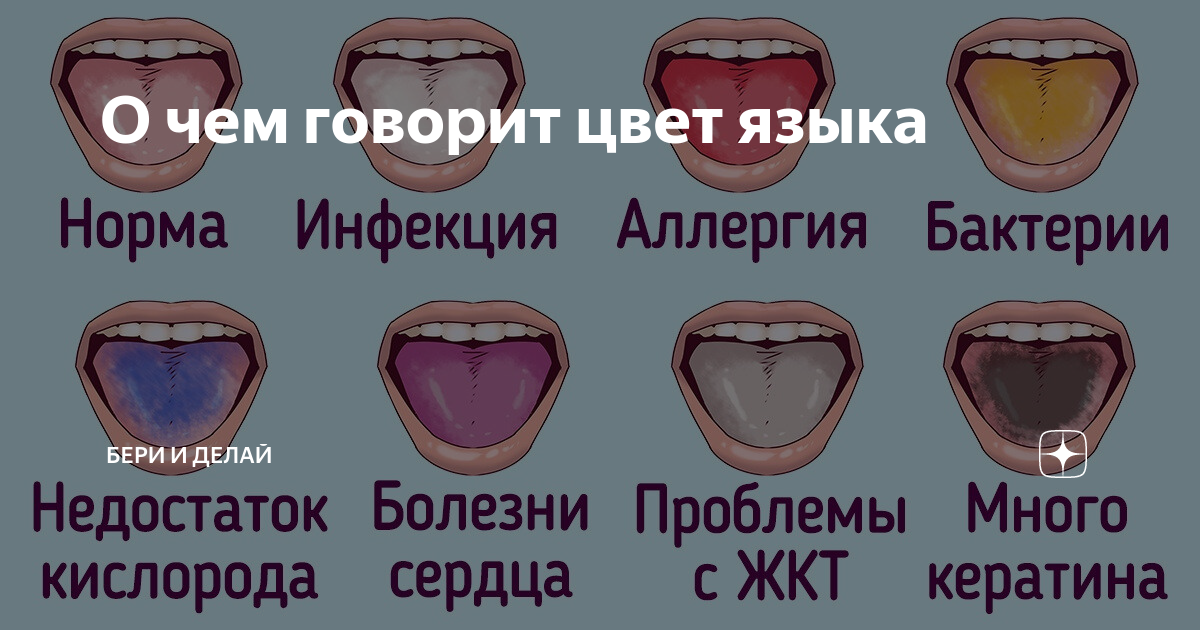 ГБУЗ СО «Тольяттинская городская клиническая больница №5» - Диагностика заболеваний по цвету языка