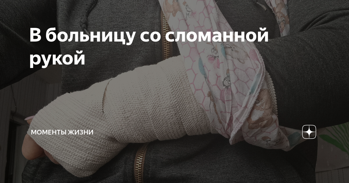 Фото для пранков в больнице со сломанной рукой