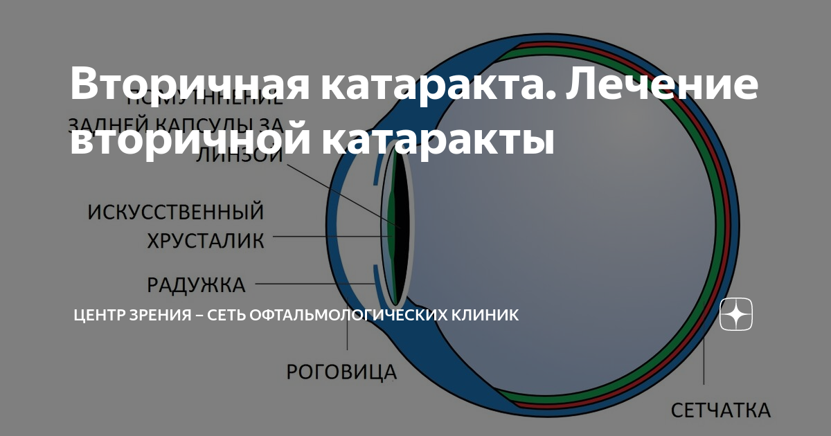 лечение вторичной аг