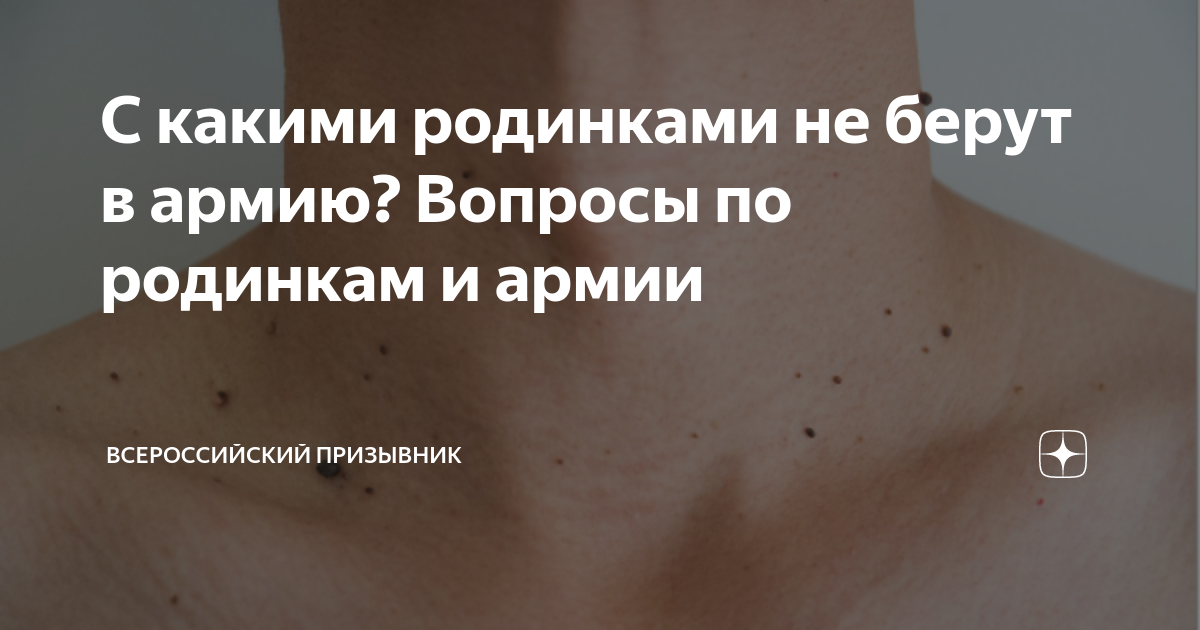 С какими родинками не берут в армию? Вопросы по родинкам и армии ...