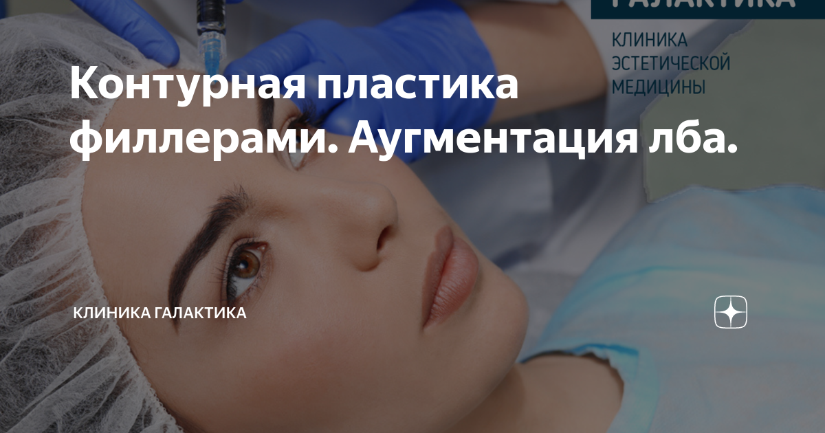 контурная пластика филлерами носа