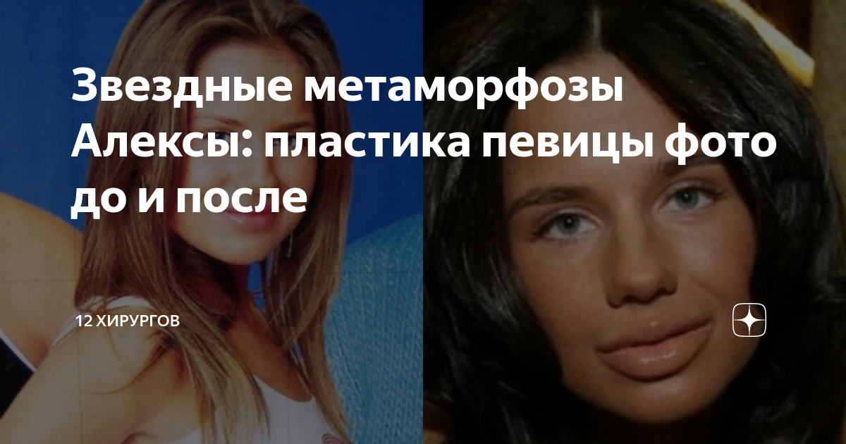 Алекса до и после пластики Звездные метаморфозы Алексы: пластика певицы фото до и после 12 хирургов Дзен