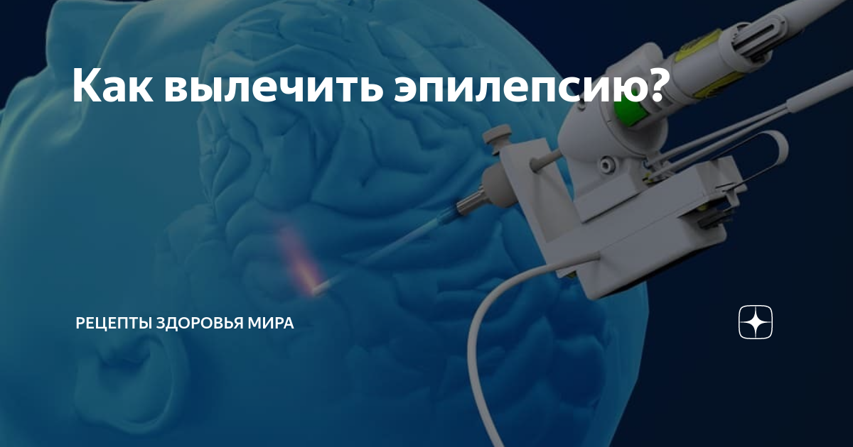 Как вылечить эпилепсию? | Рецепты здоровья мира | Дзен