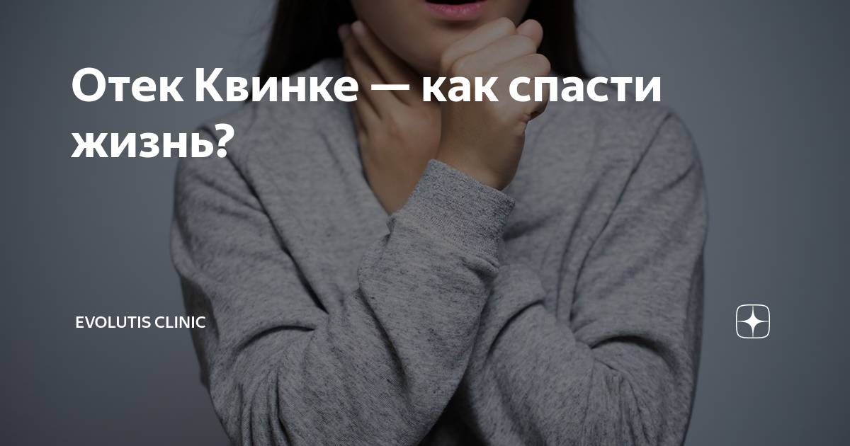 Отек Квинке — как спасти жизнь? | Evolutis Clinic | Дзен