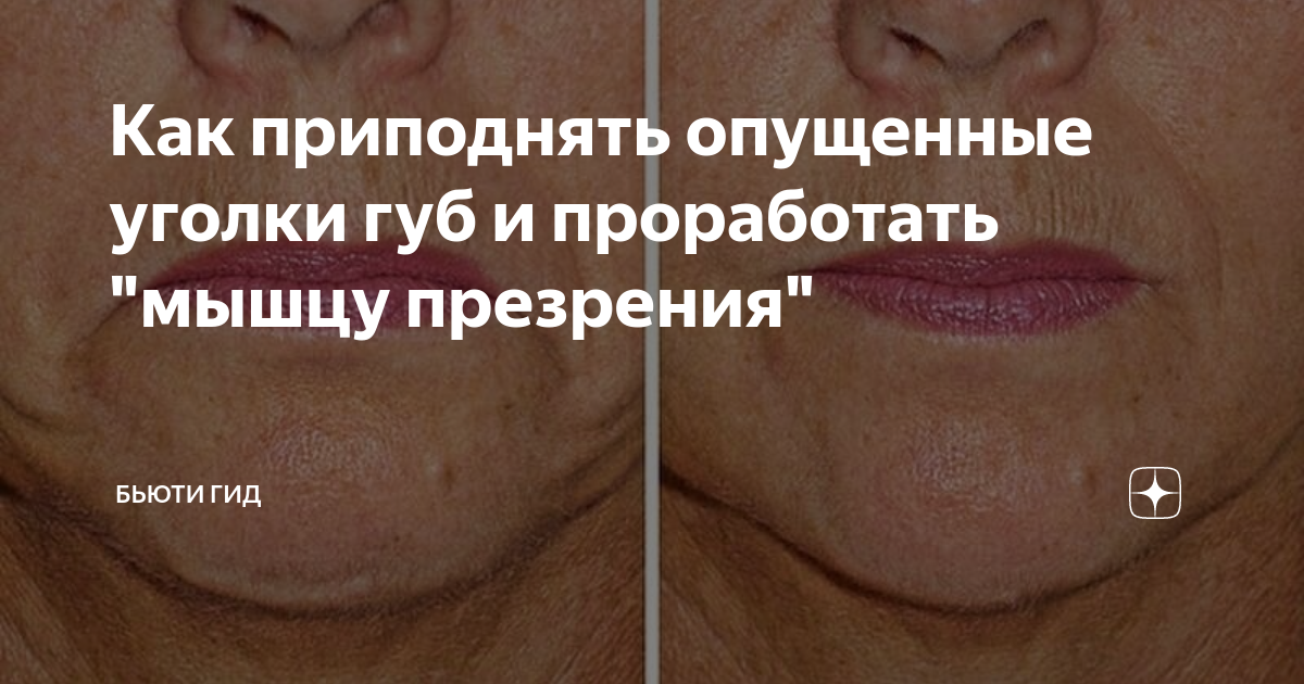 Опущены уголки губ что делать. Упражнения для поднятия уголков губ. поднять уголки губ упражнения. как приподнять опущенные уголки губ.
