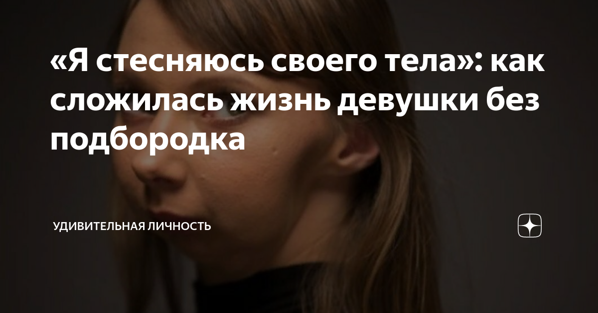 «Я стесняюсь своего тела»: как сложилась жизнь девушки без подбородка ...