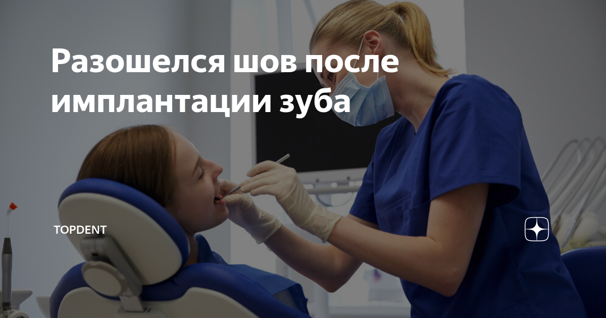 Как выглядит шов после имплантации зуба Снятие швов