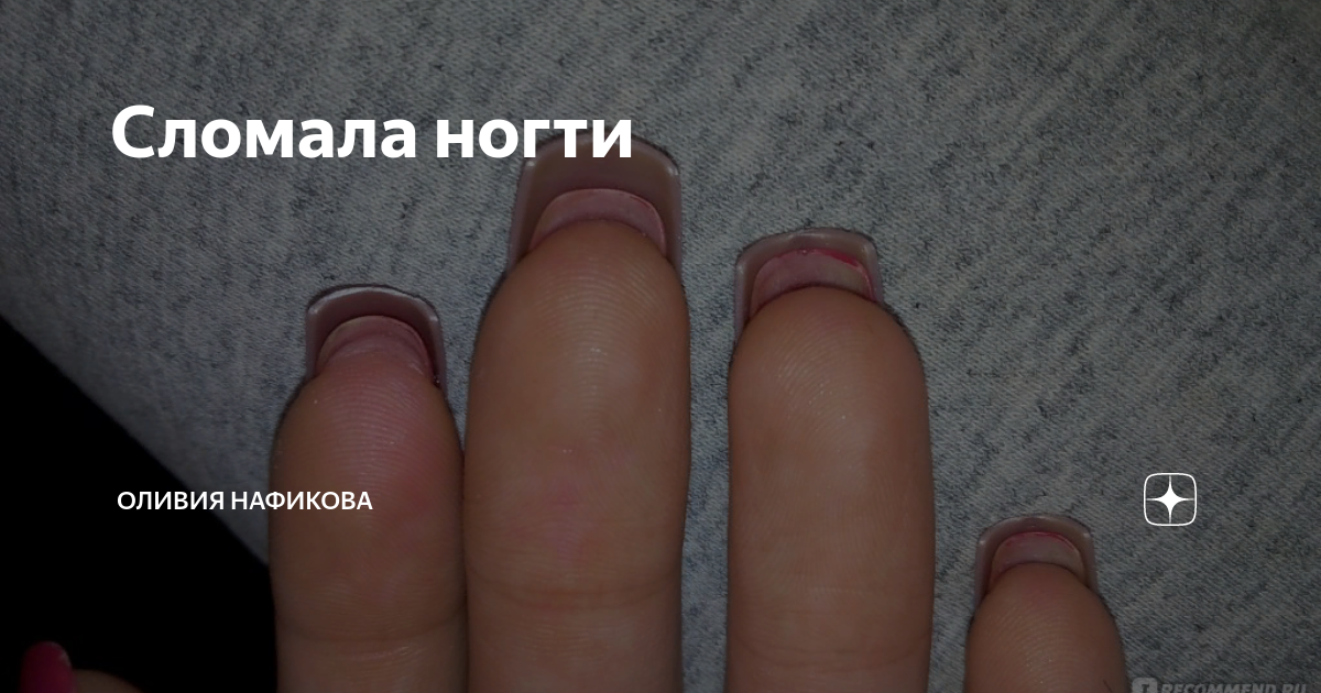 Как это развидеть? Уральский маникюрщик спилил ногти клиентки под корень