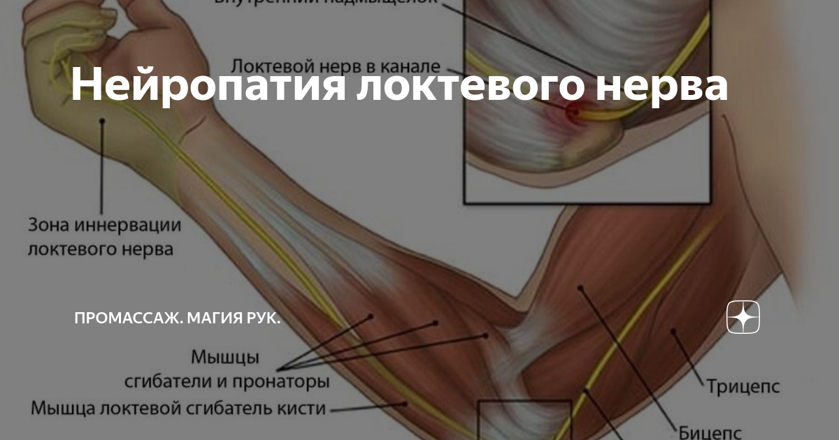 боль в локтевом нерве