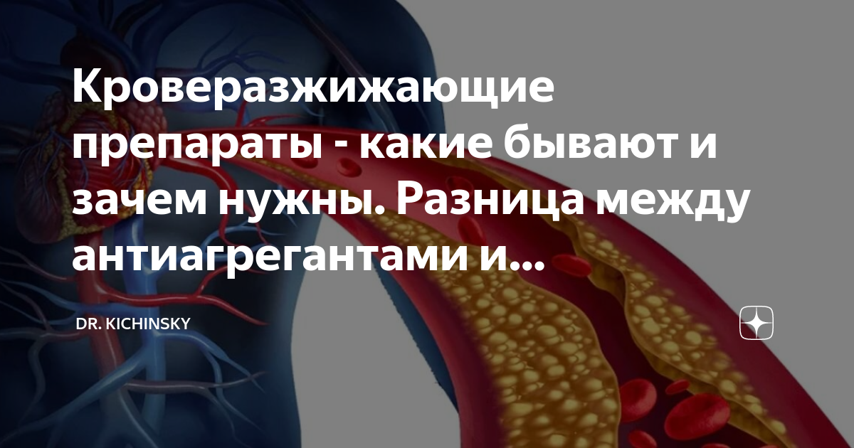 Кроверазжижающие препараты - какие бывают и зачем нужны. Разница между ...