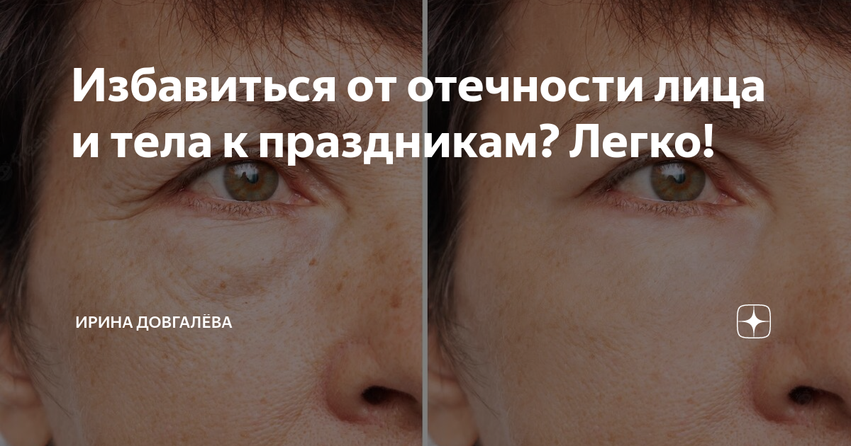 Избавиться от отечности лица и тела к праздникам? Легко! | Ирина ...