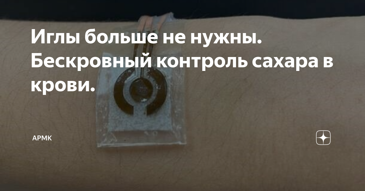 Иглы больше не нужны. Бескровный контроль сахара в крови. | АРМК | Дзен