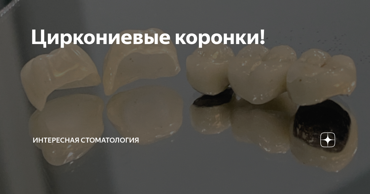 Циркониевые коронки! | Интересная стоматология | Дзен