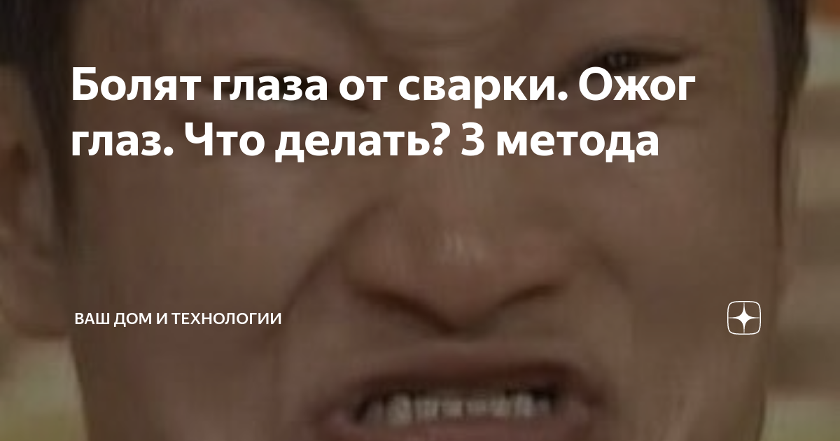 Болят глаза после сварки что делать. Нахватался зайчиков от сварки глаза. Резь в глазах от сварки.