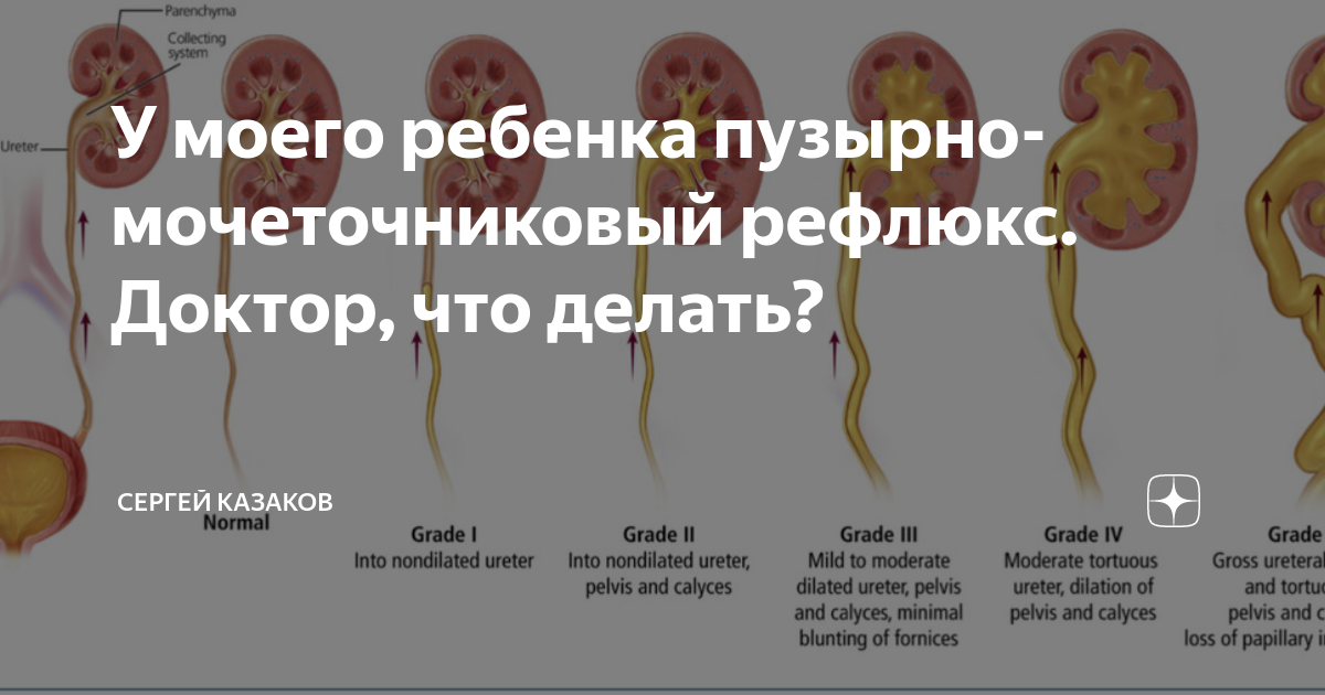 Цистит как передается. Цистит передаётся половым путём или нет. передается ли цистит от женщины к мужчине половым путем.