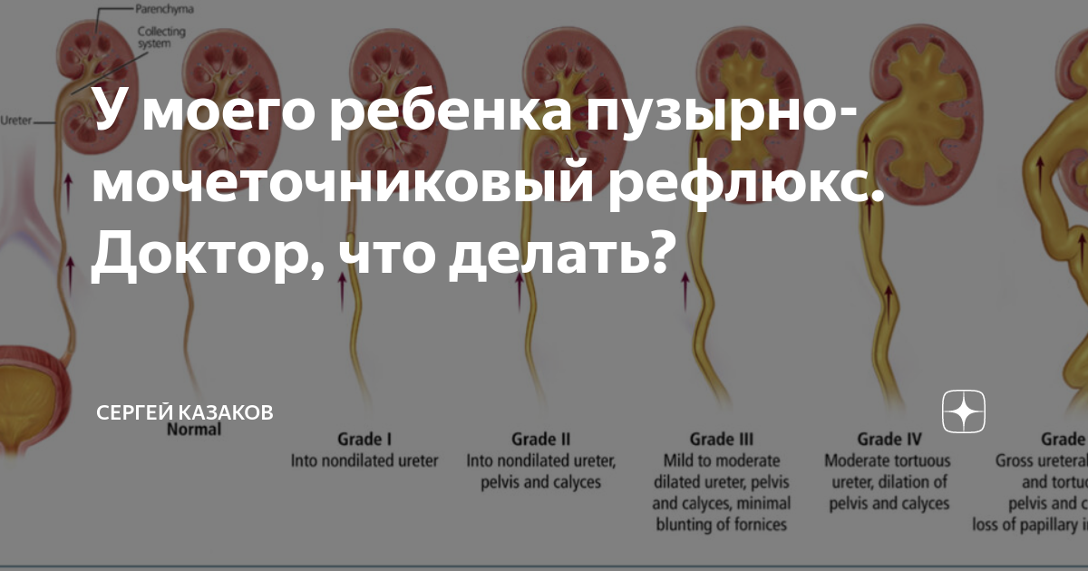 Цистит после полового акта у женщин почему