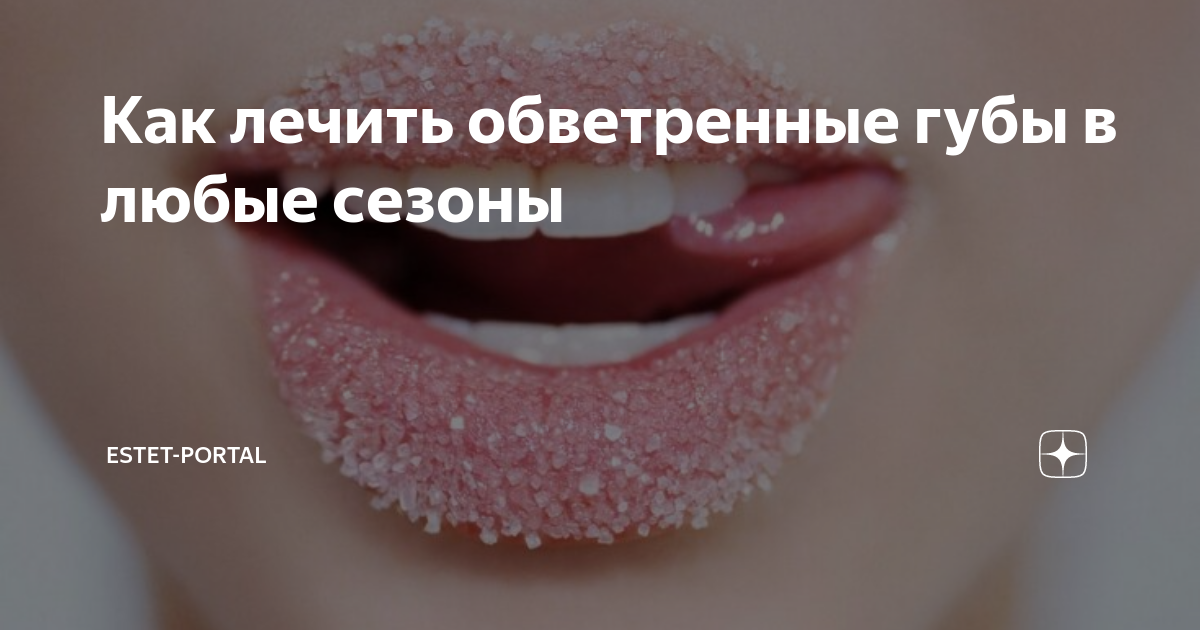 Вы точно знаете, как вылечить обветренные губы?