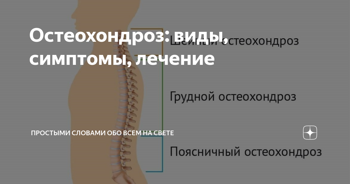 Остеохондроз виды Остеохондроз виды