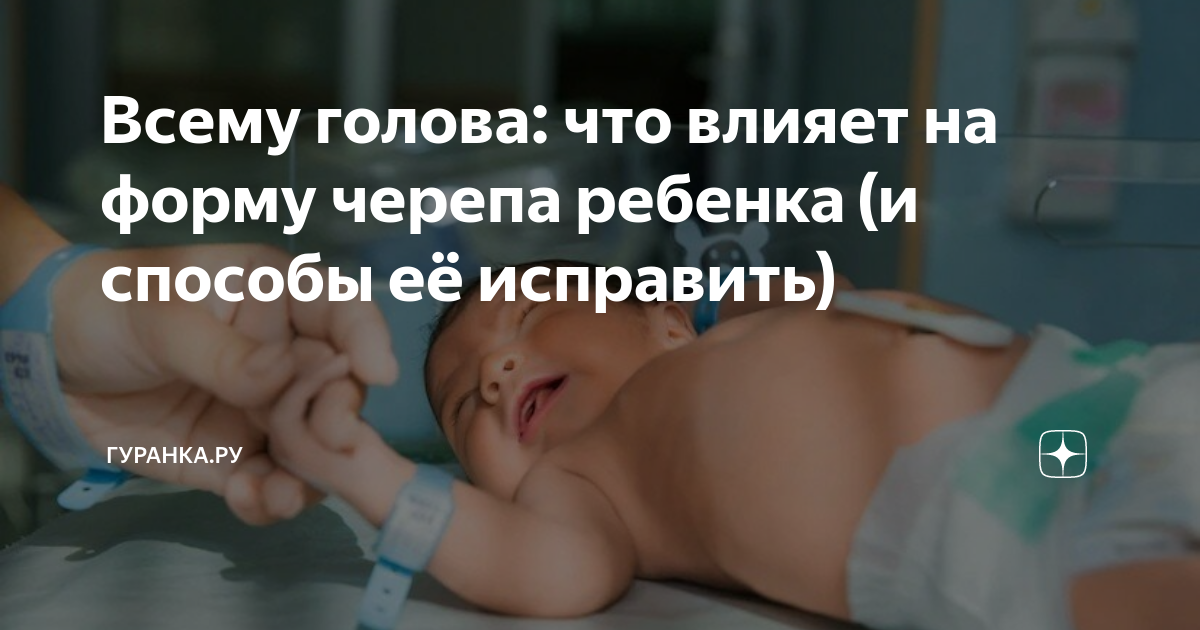 Особенности формы головы у новорожденных | статьи от Huggies