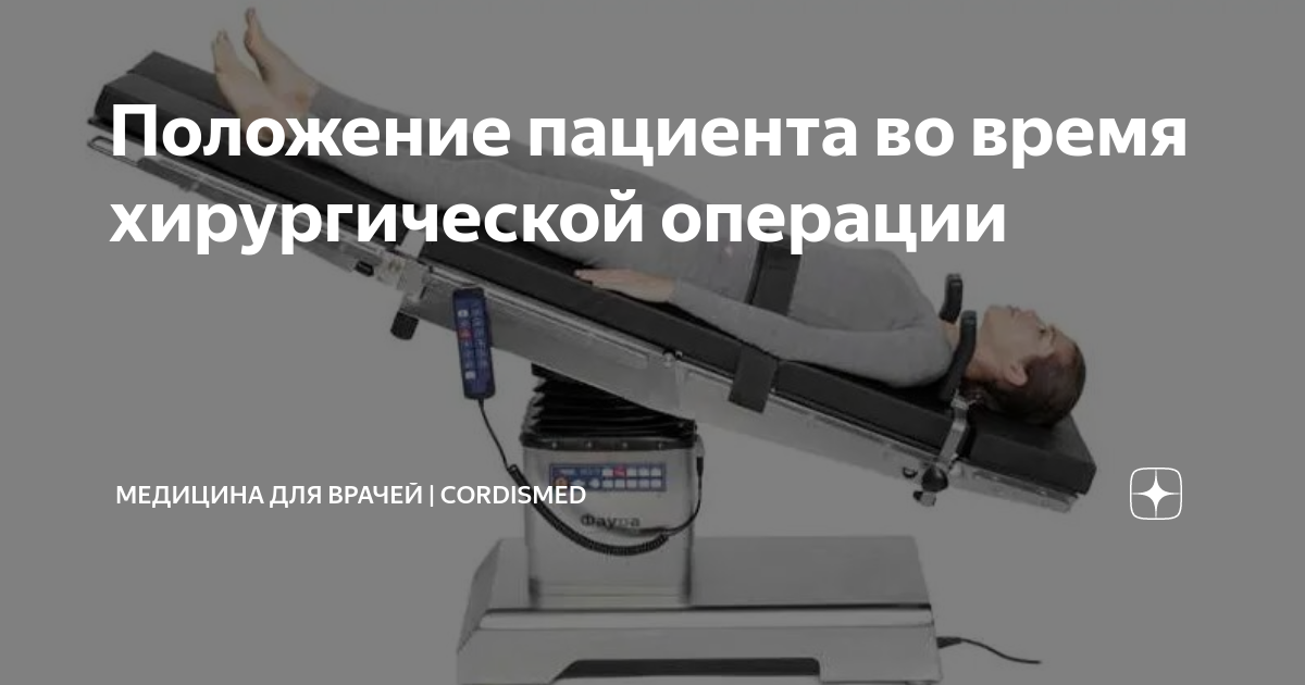 Литотомическое положение на операционном столе это